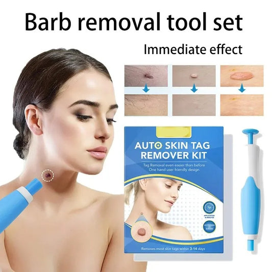 Wart Remover Pen